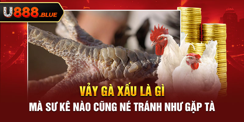 Vảy Gà Xấu Là Gì Mà Sư Kê Nào Cũng Né Tránh Như Gặp Tà